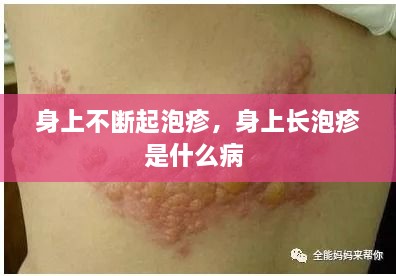 身上不斷起泡疹，身上長(zhǎng)泡疹是什么病 