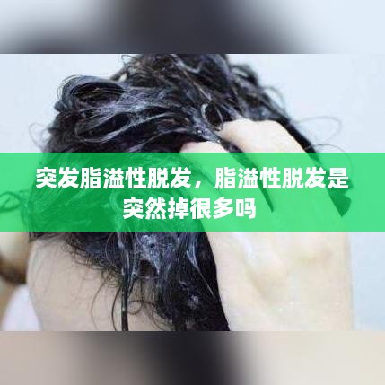 突發(fā)脂溢性脫發(fā)，脂溢性脫發(fā)是突然掉很多嗎 