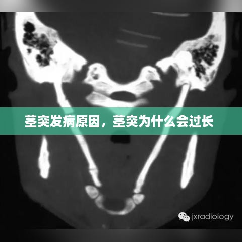莖突發(fā)病原因，莖突為什么會(huì)過(guò)長(zhǎng) 
