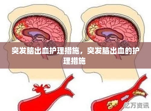 突發(fā)腦出血護理措施，突發(fā)腦出血的護理措施 