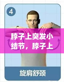 脖子上突發(fā)小結節(jié)，脖子上的小結節(jié)要緊嗎 
