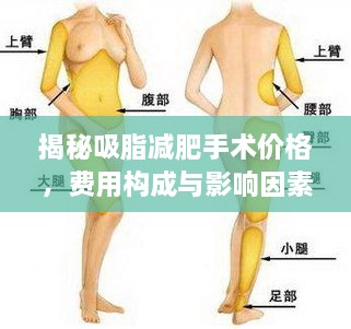 揭秘吸脂減肥手術(shù)價(jià)格，費(fèi)用構(gòu)成與影響因素全解析